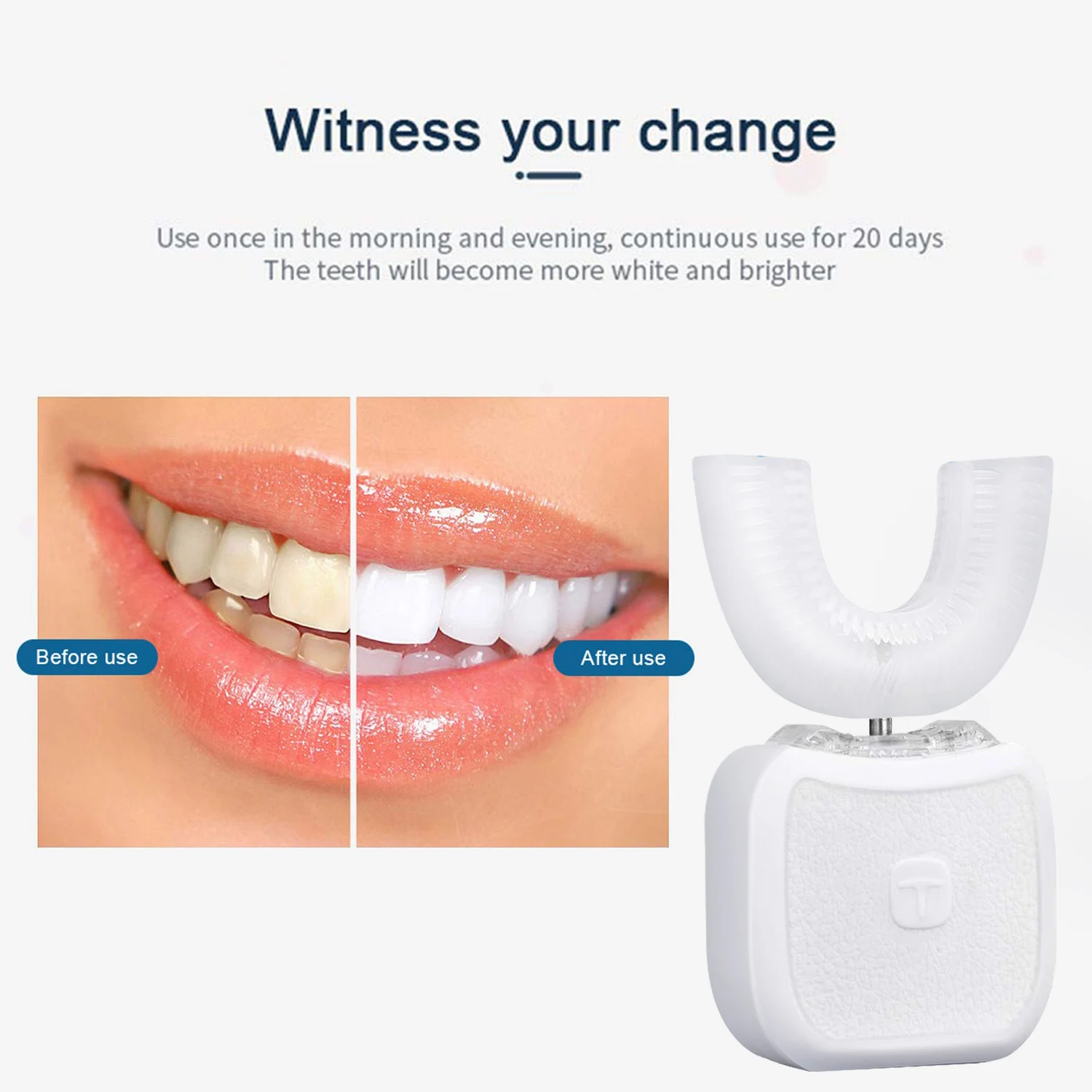 Automatsko Zvučna četkica za zube U USB Punjenje Intelektualno IPX7 Vodootporan Ultrazvučno Električna Četkica za zube Za oralnu Njegu i Izbjeljivanje Zubi Slika  3