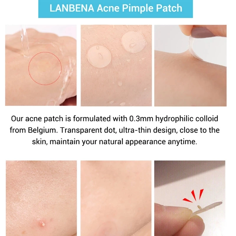 LANBENA Akne od Akni Krpa Nevidljive Naljepnice od acne Liječenje Akni Majstor Za Uklanjanje akni Kozmetički Alat Za Njegu Kože Slika  5